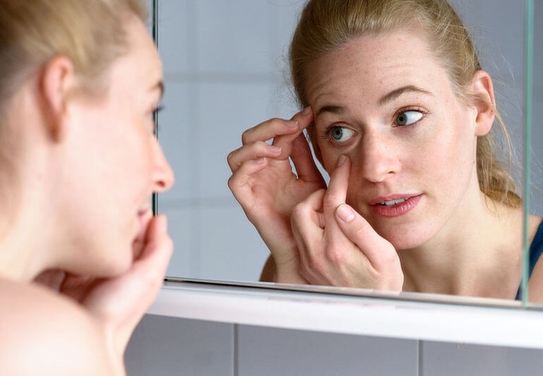 Puffy Eyes: What Causes Them and What To Do About It